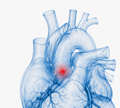 Cardiac Health