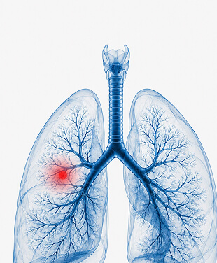 Respiratory Health